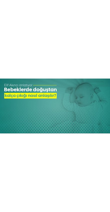 Bebeklerde Doğuştan Kalça Çıkığı Nasıl Anlaşılır?