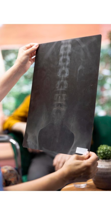 BSPTS (Barselona Skolyoz Fizik Tedavi Okulu) Schroth Yöntemi