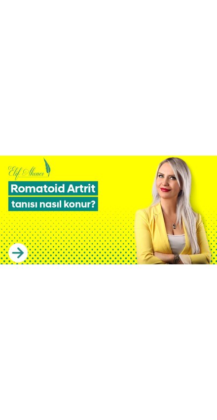 Romatoid Artrit Tanısı Nasıl Konur? Romatoid Artrit Tanısı Nasıl Konur?