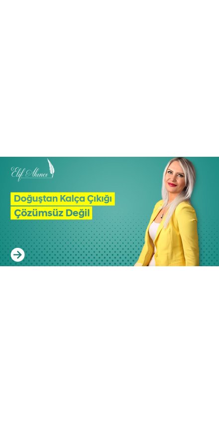 Doğuştan Kalça Çıkığı Çözümsüz Değil