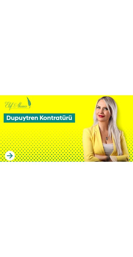 Dupuytren Kontratürü