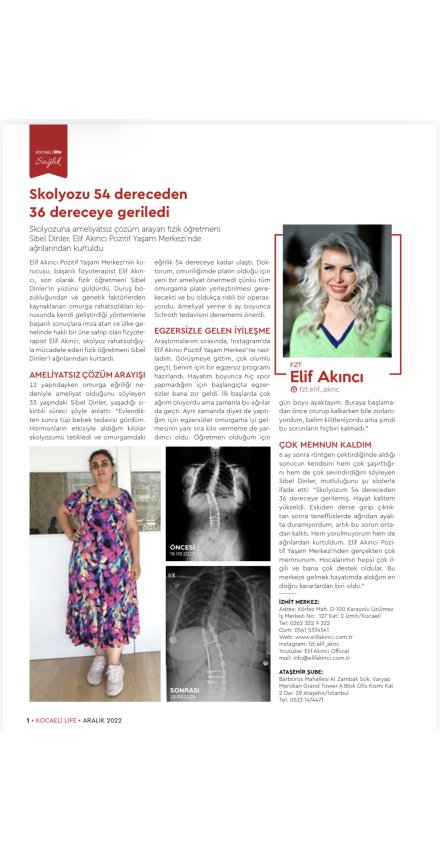 SİBEL DİNLER'İN SKOLYOZU 54 DERECEDEN 36 DERECEYE GERİLEDİ!