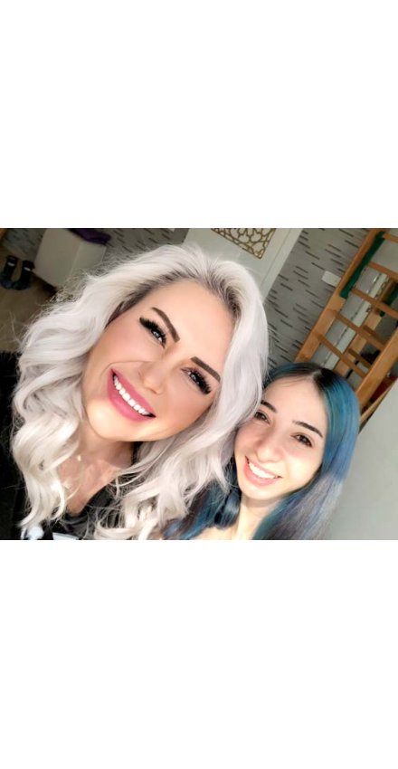 GÖNÜL YÜZSEVEN: SKOLYOZUM 3 AYDA 17 DERECE GERİLEDİ GÖNÜL YÜZSEVEN: SKOLYOZUM 3 AYDA 17 DERECE GERİLEDİ