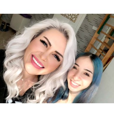 GÖNÜL YÜZSEVEN: SKOLYOZUM 3 AYDA 17 DERECE GERİLEDİ