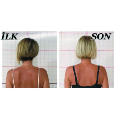 MİNE NAZAN KERİMAK ÖNER: İKİ OMUZUM EŞİTLENDİ