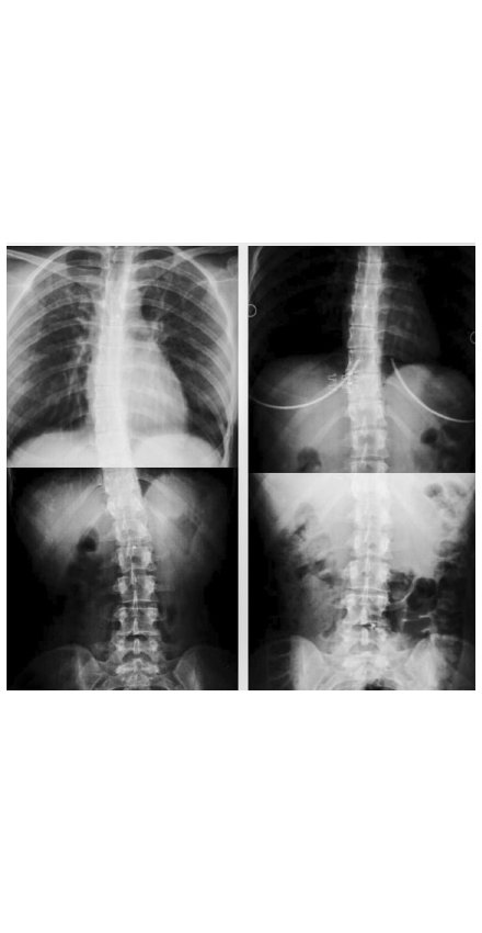 Fizyoterapist Elif Akıncı ile Başarı Hikayesi Fizyoterapist Elif Akıncı ile Başarı Hikayesi
