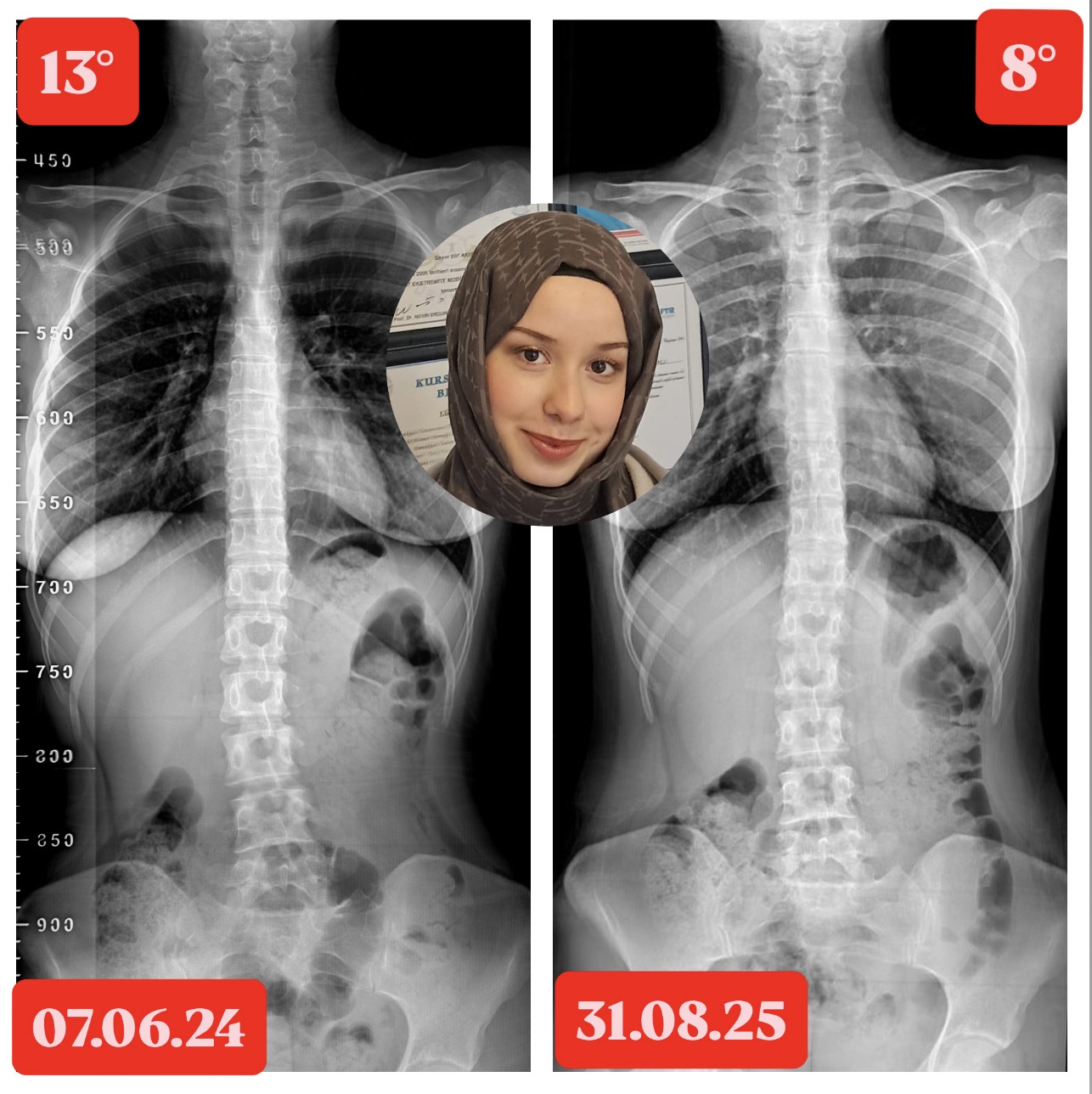Sonuçlarımız