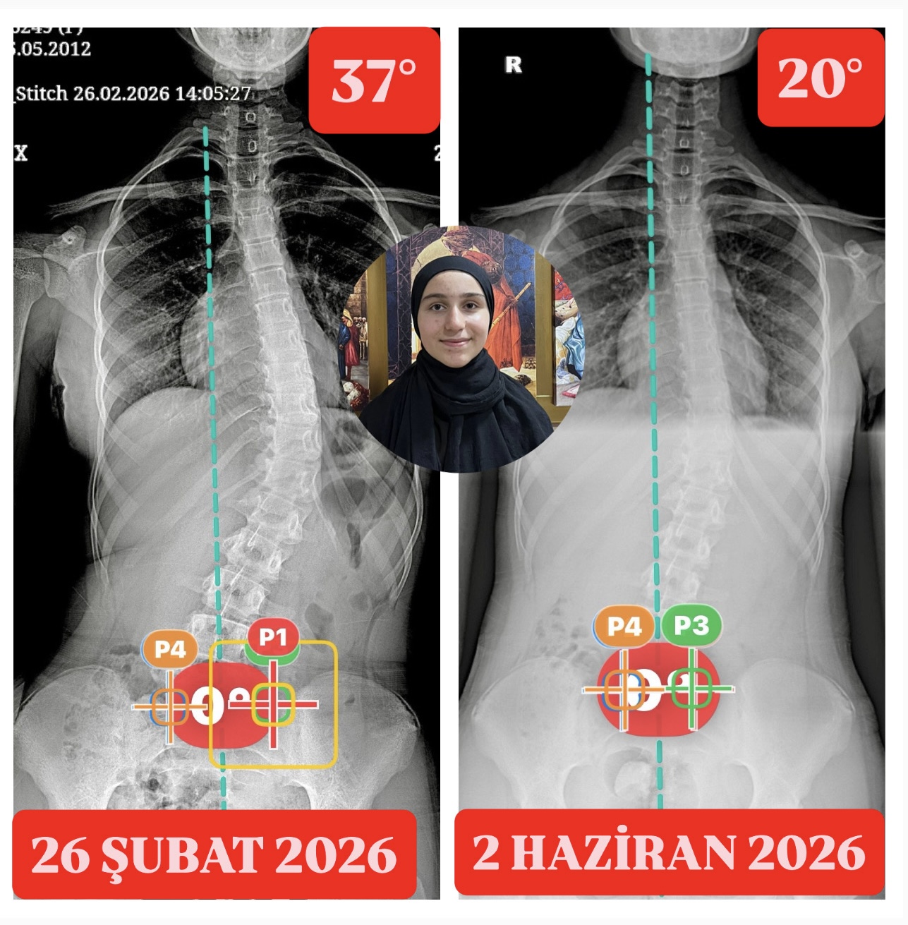 Sonuçlarımız